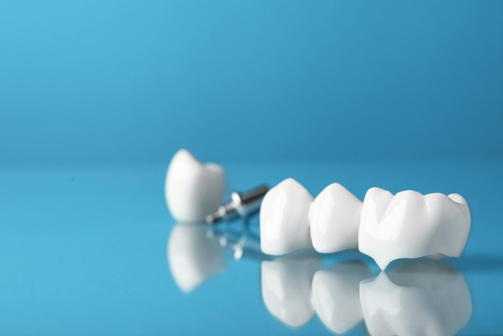 A dental crown and a dental bridge sitting in front of a blue background